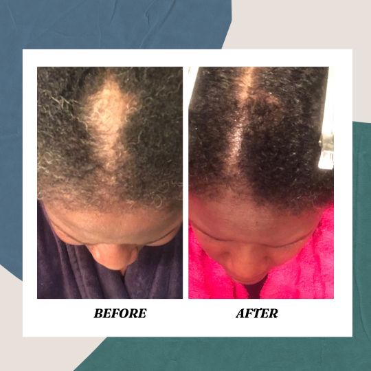 Beaucoup Beauty's Rejuvenating Hair & Scalp Elixir