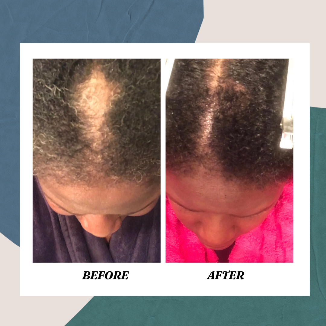 Beaucoup Beauty's Rejuvenating Hair & Scalp Elixir (Mini)